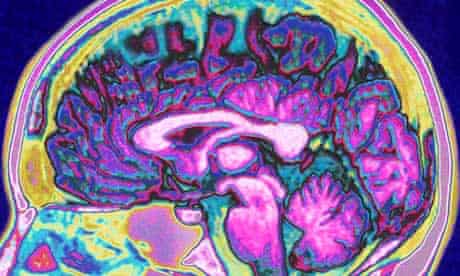 A-scan-of-the-human-brain-007